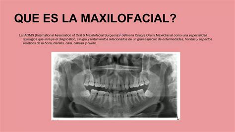 Maxilofacial Cirugia Ppt