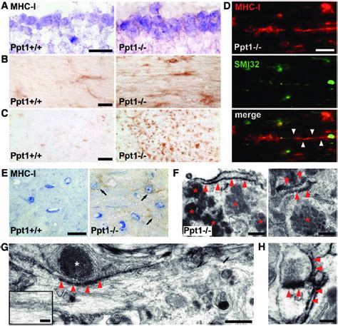 Increased Surface Expression Of MHC Class I On Neurons In Ppt1 Mice