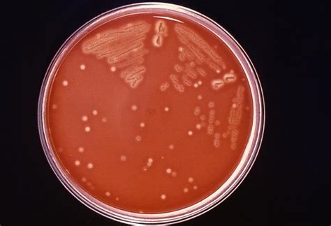 Streptococcus Pyogenes Wikidoc