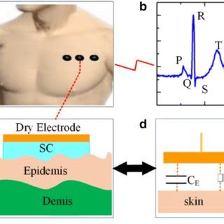 Stable ECG Signal Recording Via The Soft Dry Bio Potential Electrode