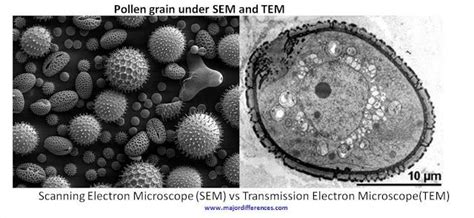 SEM Vs TEM Scanning Electron Microscope Electron Microscope