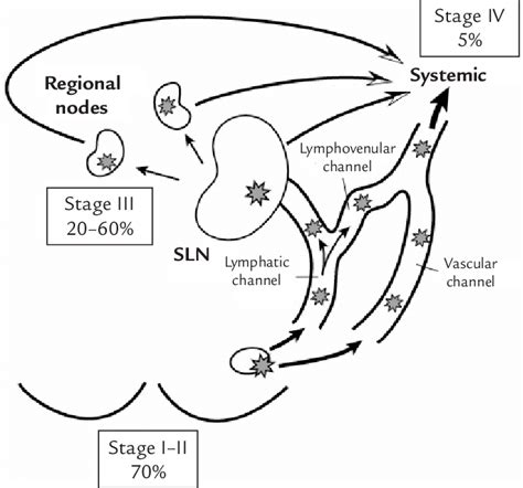 Patterns Of Metastasis With Corresponding Survival Rates For Breast Download Scientific Diagram