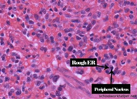 spleen-slide-labelled-histology | SchoolWorkHelper