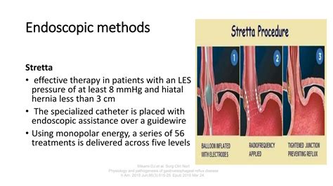 Approach Indications And Surgical Management Of Gerd 2 PPT