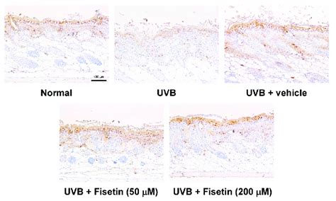 Immunohistochemical Staining Of Aquaporin Expression In The Epidermis