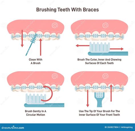 how to brush your teeth braces 6
