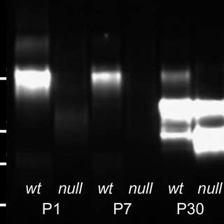 Cadm Distribution In The Membranes Of Epithelial And Superficial Fiber