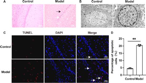 Morphological changes of hippocampus in epileptic rats. (A) Hematoxylin ... 