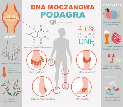 Dna Moczanowa Co To Jest I Jak Si Objawia Portal Dermatologiczny The