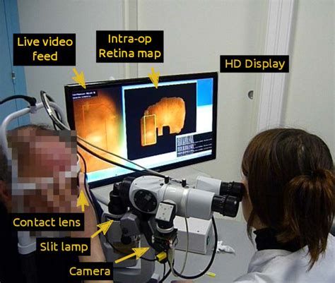 Figure 1 From Fundus Image Mosaicking For Information Augmentation In