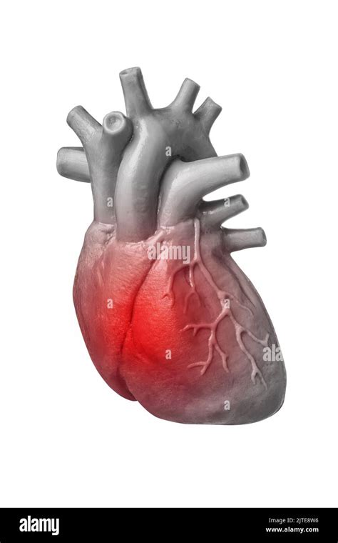 El Concepto De Dolor De Corazón O Ataque Al Corazón Corazón Humano