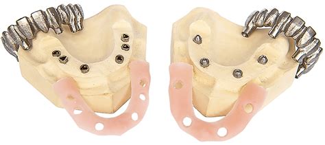 Medimatch Dental Laboratory Digital Dental Lab London Uk