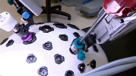 First robotic surgery on prostate patient in Leicester - BBC News