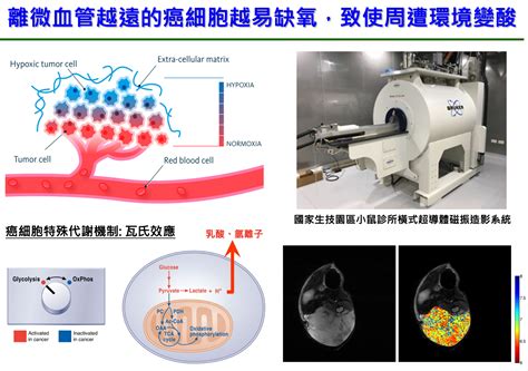 為何癌細胞不怕酸中毒？國衛院發現酸性微環境壓力機轉 Technews 科技新報