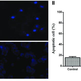 Apoptosis And Dna Fragmentation Inhibition Effect Of Epalrestat In