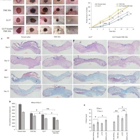 LL37 Loaded TMC HA Composite Accelerate Wound Healing A