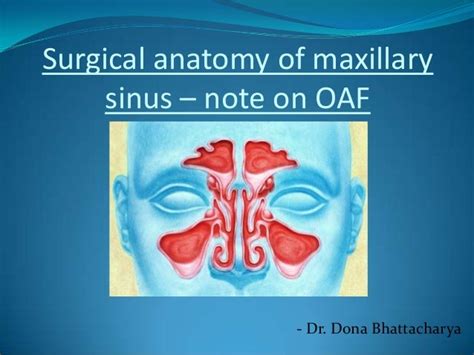 Surgical Anatomy Of Maxillary Sinus Note On 2