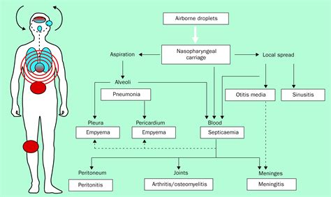 Life Cycle Of Streptococcus Pneumoniae