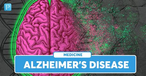 Alzheimer’s Disease: Symptoms, Causes and Treatment