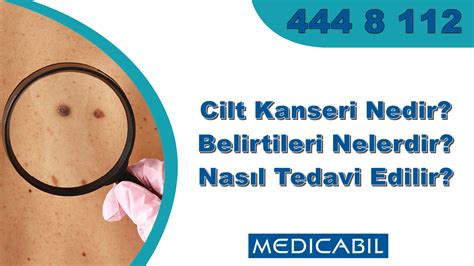 Cilt Kanseri Nedir Deri Kanseri Belirtileri Nelerdir Tedavi Y Ntemleri