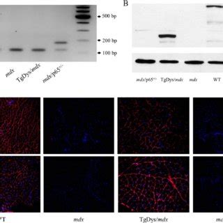 P Genotype Confirmation And Dystrophin Minidystrophin Detection A