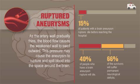 Infographic Brain Aneurysms Becky Menendez