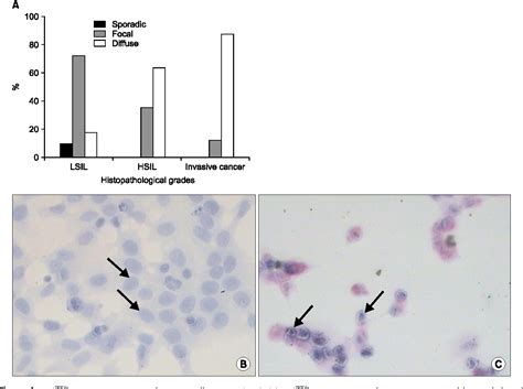 Figure 1 From Human Papillomavirus Genotyping And P16INK4a Expression