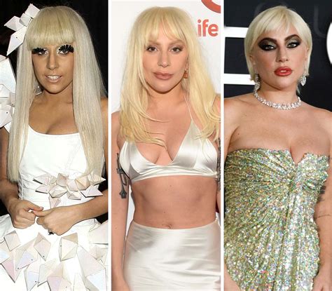 Did Lady Gaga Get Plastic Surgery What She S Said About It Life And Style