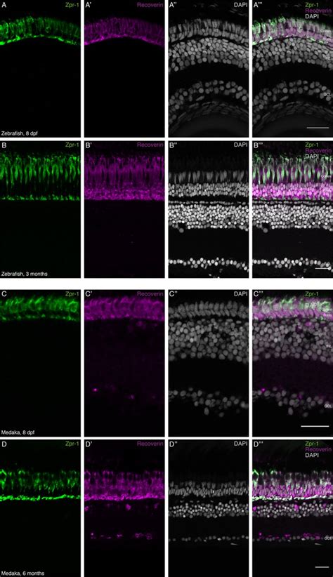 Figures and data in Activating the regenerative potential of Müller ...