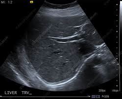 Ultrasound Archives - Aznostics | The Diagnostic Center Lahore