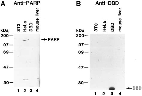 Specificity of anti-PARP and anti-PARP N-terminal antiare shown in Fig ...