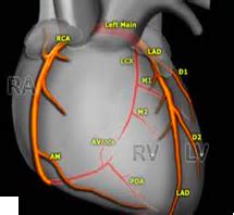 Acute Coronary Syndromes ACS Flashcards Quizlet