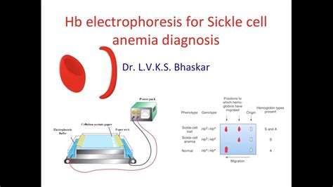 Hemoglobin Sc Disease Electrophoresis - Pregnancy Depression