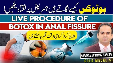 How To Treat Chronic Anal Fissure With Botox Injection Stepwise Procedure Explained Dr