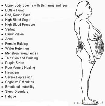 Cushing’s Syndrome Symptoms Causes and Treatment | MedicScientist ...