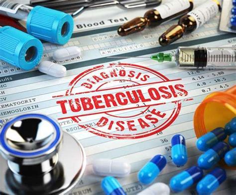 World Tuberculosis Day 2022 Know About Its History Significance And Theme For This Year