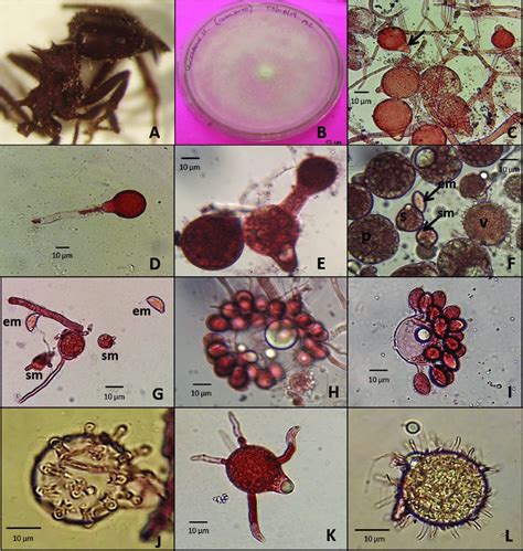 Macro And Micromorphological Features Of Conidiobolus Lunulus