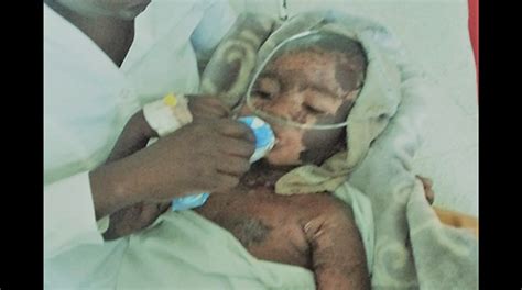 Picmystery Rocks Binga Village As Toddler Wakes Up With Burns In