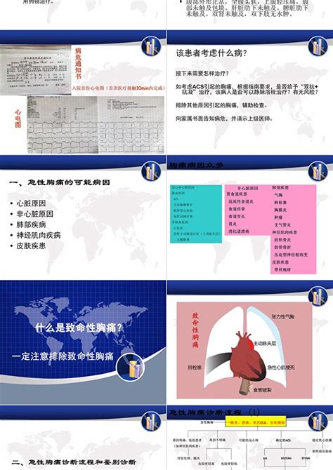 急性胸痛诊断流程及鉴别诊断思路课件ppt模板卡卡办公