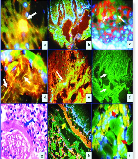 a. Double IIF staining utilizing FITC conjugated anti-human IgG ...