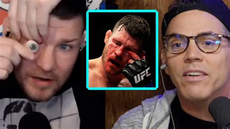 Michael Bisping Removes His Eye For Steve O Wild Ride Clips YouTube