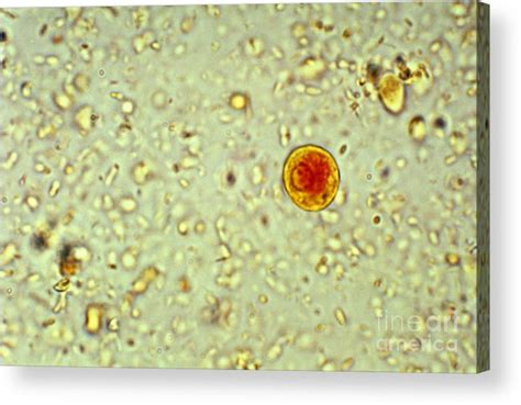 Entamoeba Histolytica Cyst Acrylic Print By Science Source Pixels