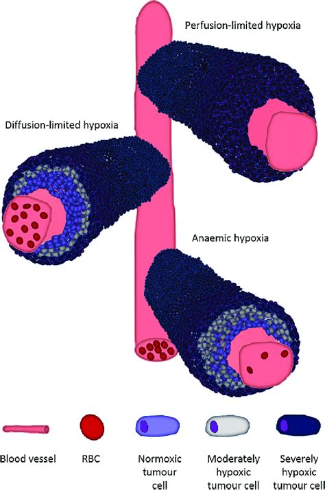 Diagram outlining the mechanisms of hypoxia development in solid ...