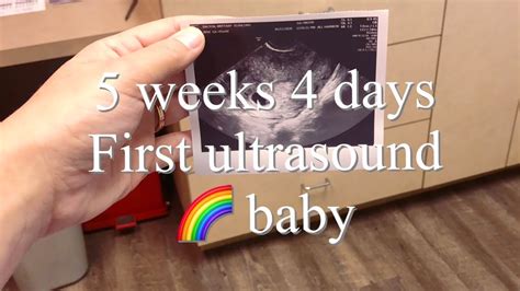 First Ultrasound At 5 Weeks 4 Days Expecting After Miscarriage Life With Brittany Youtube