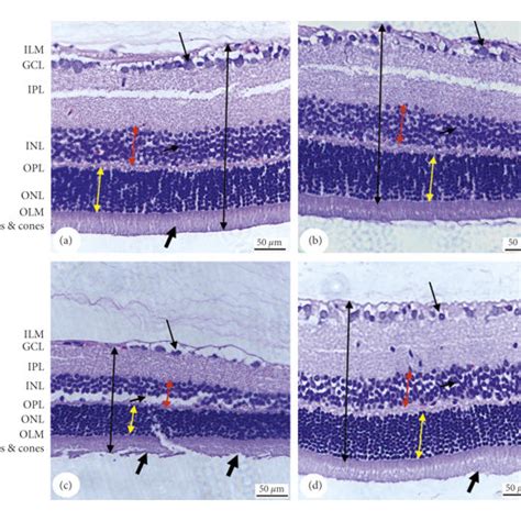 Histopathological Photomicrographs Of The Retina Of All Groups Of Rats