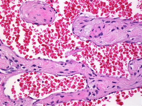 A Collection Of Surgical Pathology Images