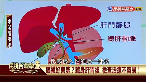 【民視台灣學堂】樂活醫學堂 沉默的隱形殺手 胰臟癌的認識與治療 2017 06 29—陳瑞杰 Youtube