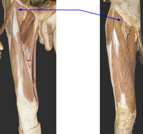 Lower Extremity And Pelvis Muscles And Neurovasculature Mock Anatomy