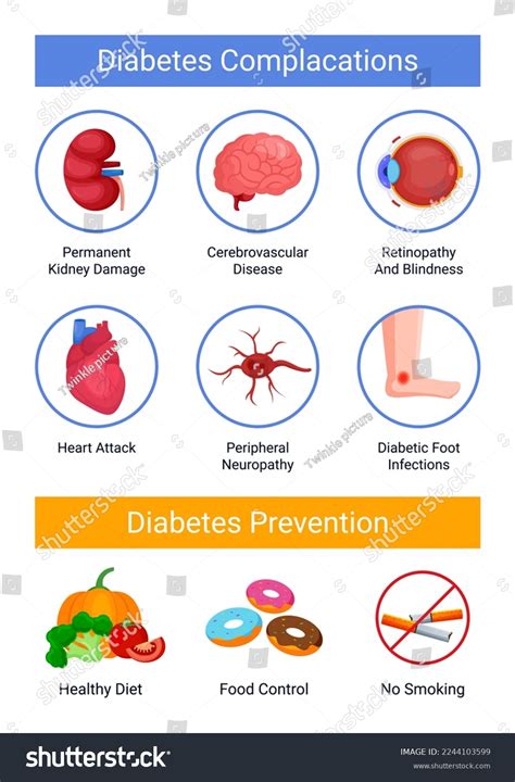 Diabetes Complications Prevention Infographic Stock Vector Royalty