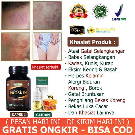 Jual Obat Gatal Selangkangan Babak Kadas Kurap Kudis Herpes Kelamin